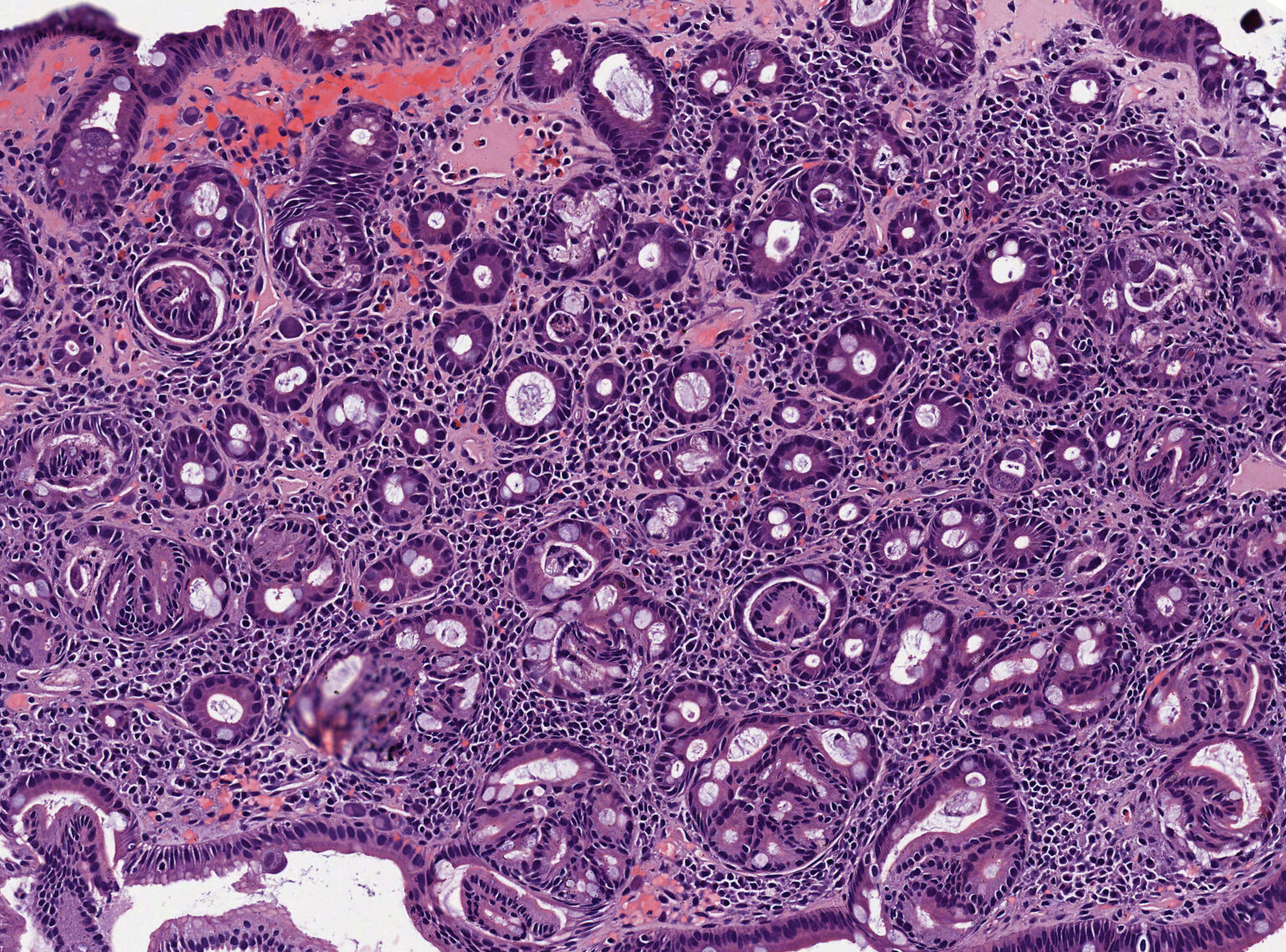 Functional Nutrition Counselor Functional Nutrition Alliance Functional Nutrition Counselor Functional Nutrition Alliance