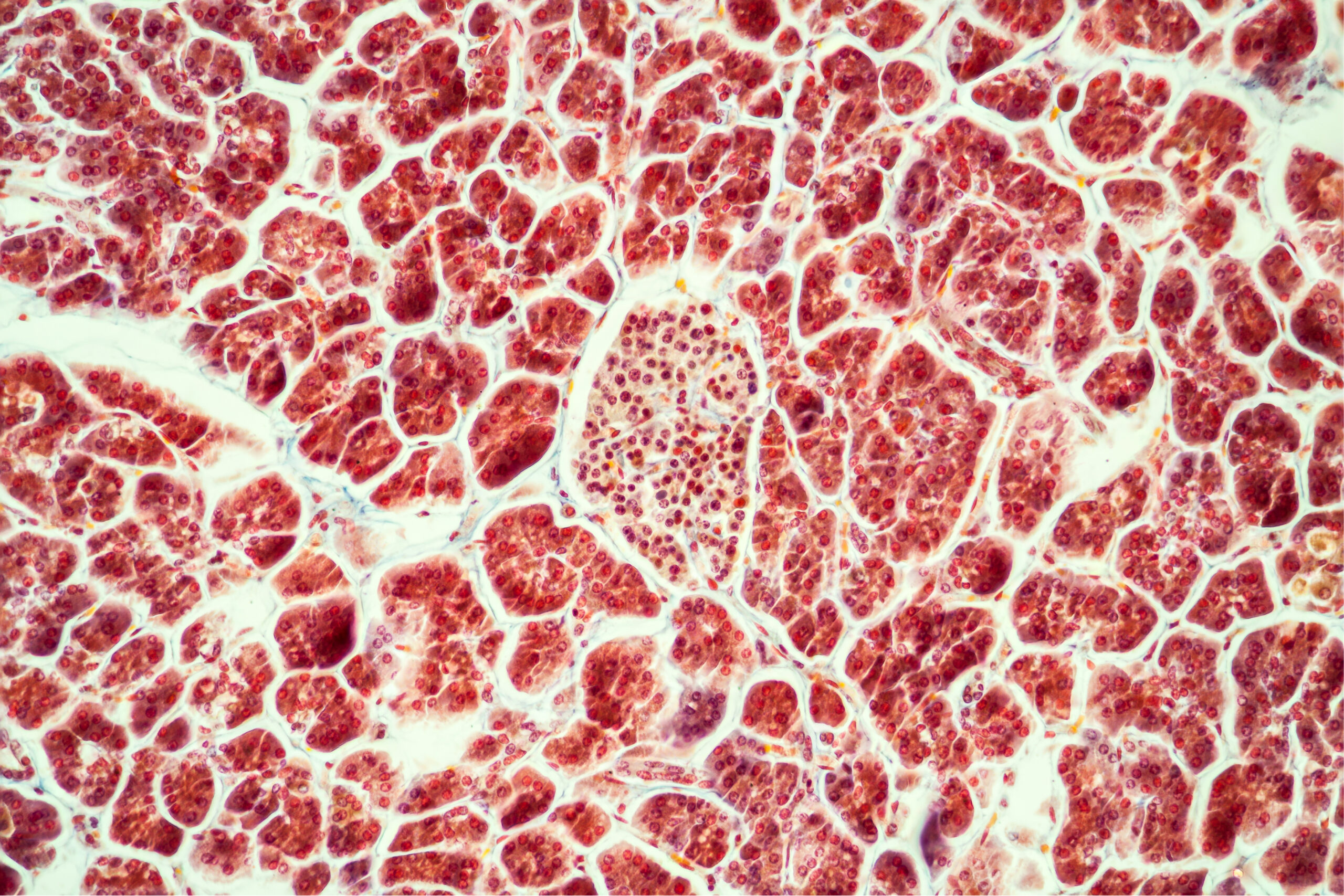 Functional Nutrition Tool Blood Sugar Balance Done 4 You Functional Functional Nutrition Tool Blood Sugar Balance Done 4 You Functional