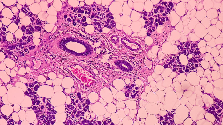 Detoxification, Immune Health, Inflammation