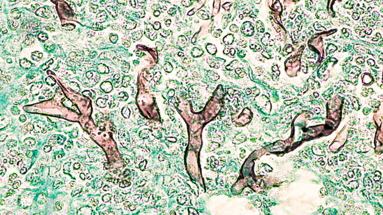 Systems, Tools